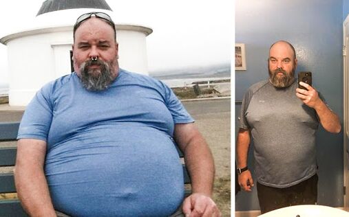 Pictures Before and After Keto Probiotix Course, Experience Using Capsule With Migter from Venice